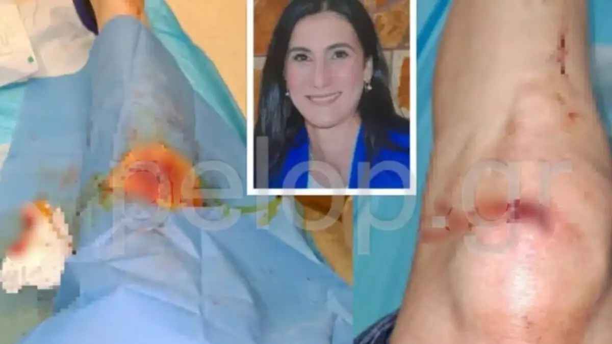 ksilodarmos patra
